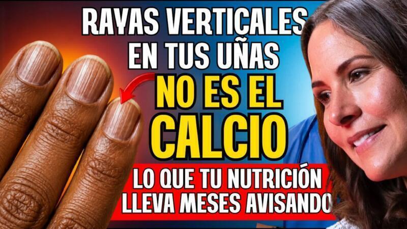 RAYAS VERTICALES EN TUS UÑAS: lo que debes observar después de los 60 antes de ignorarlo